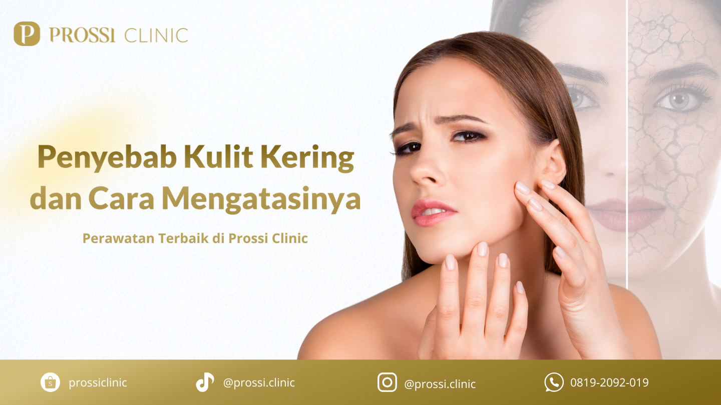 Penyebab Kulit Kering dan Cara Mengatasinya