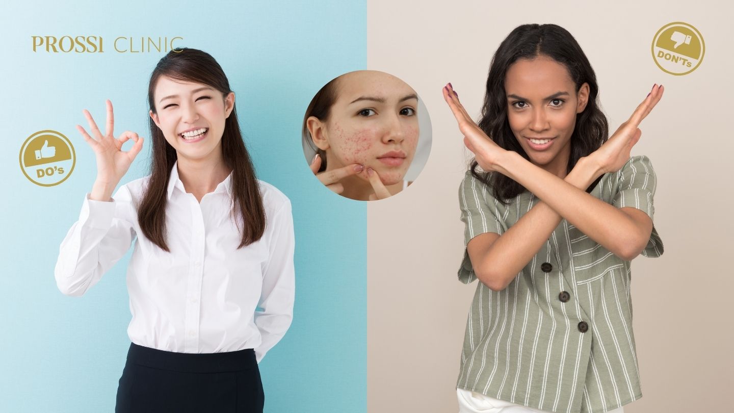 Do & Don’t Perawatan Kulit Berjerawat: Tips yang Wajib Kamu Tahu Agar Jerawat Cepat Hilang