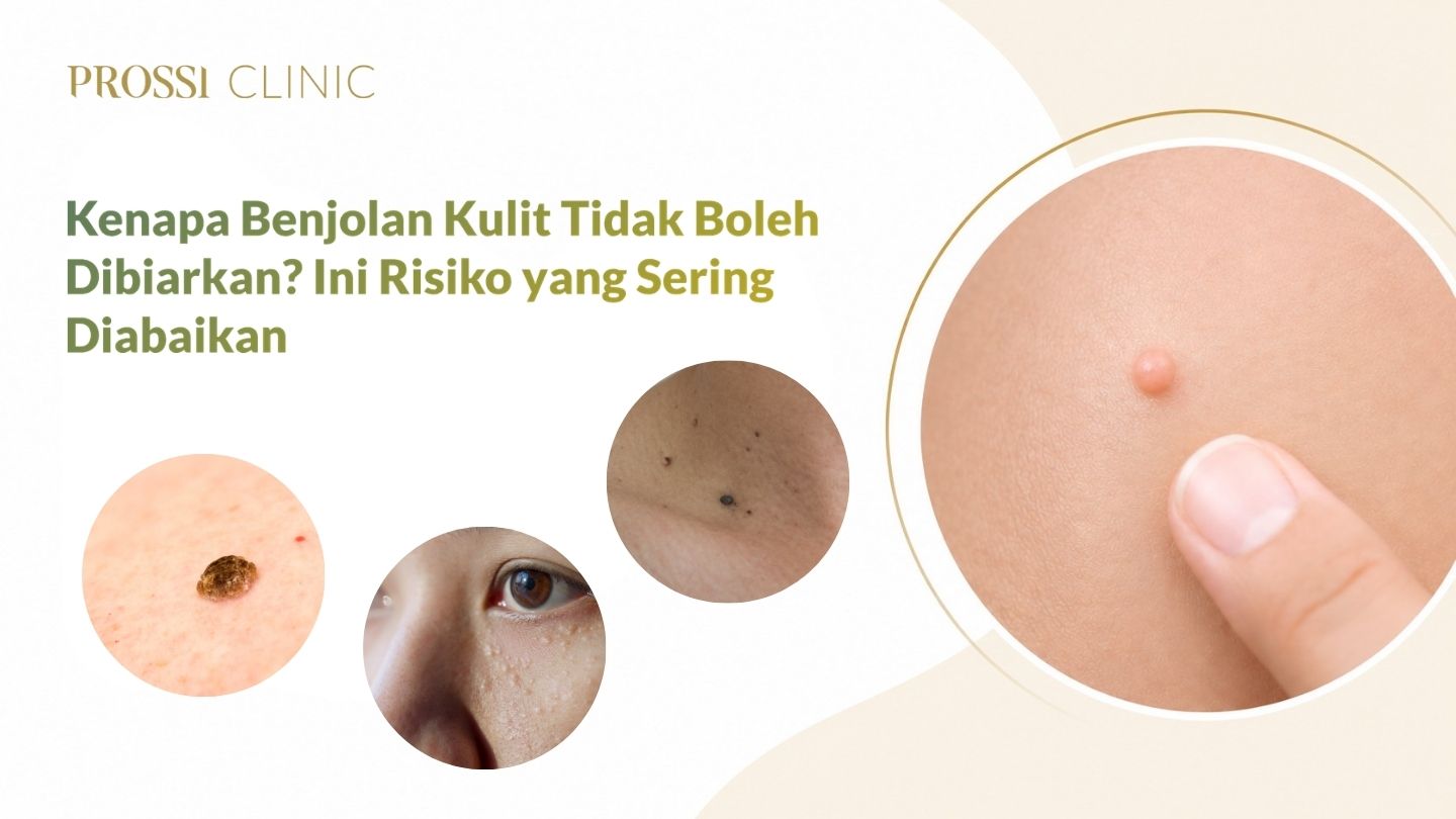 Kenapa Benjolan Kulit Tidak Boleh Dibiarkan? Ini Risiko yang Sering Diabaikan  