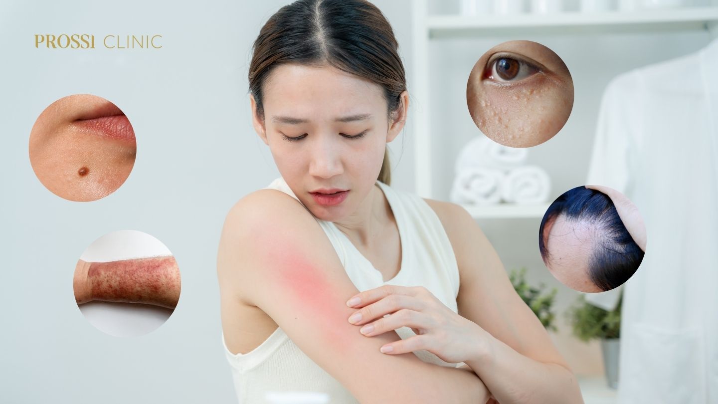 New Skin Program: Solusi Lengkap Atasi Berbagai Masalah Kulit dalam Satu Tempat di Prossi Clinic